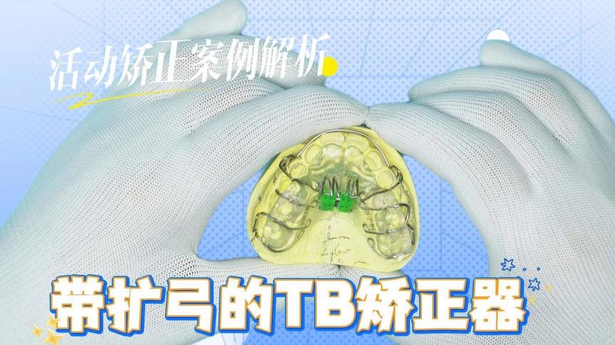 Tb正畸矫治器-图3
