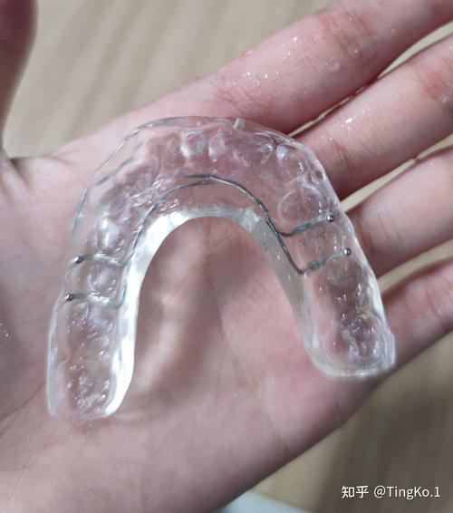 正畸全包式合垫能解决哪些牙齿矫正咬合问题？-图2