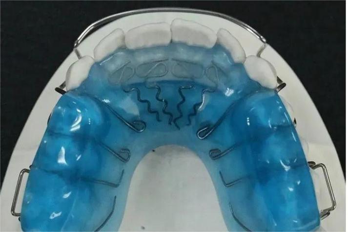 正畸全包式合垫能解决哪些牙齿矫正咬合问题？-图1