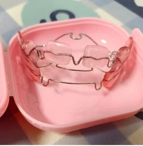 颌骨正畸矫正器-图2