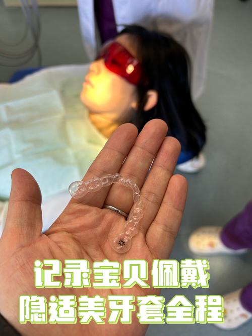 隐适美开颌正畸-图1