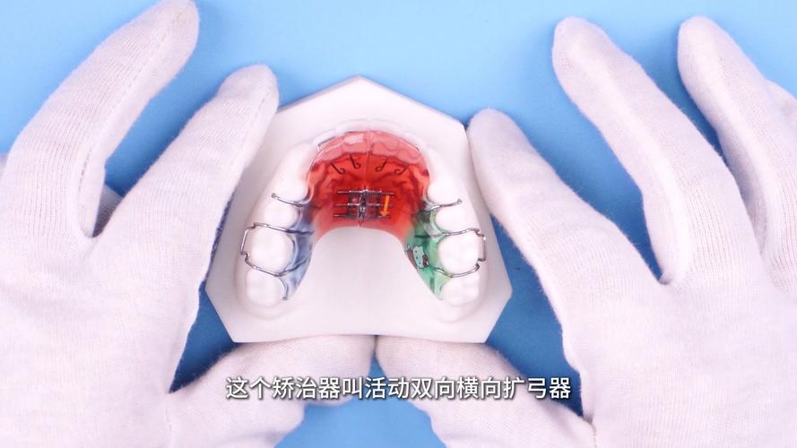 正畸矫治器发展-图3