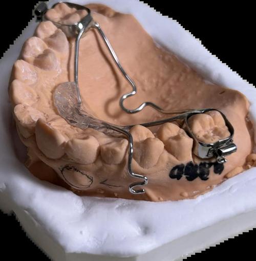 可摘牵引钩正畸-图1