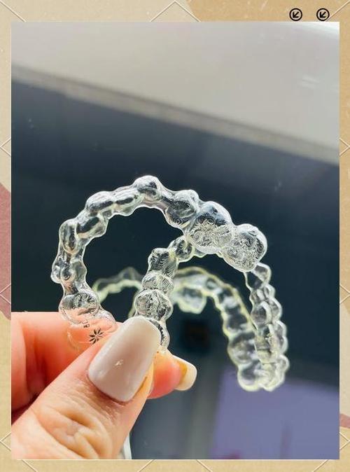 隐适美正畸注意-图3