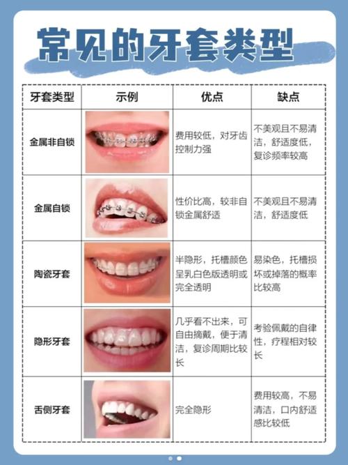 正畸牙套种类多,金属、隐形、陶瓷等具体区别在哪?-图2 正畸牙套种类多,金属、隐形、陶瓷等具体区别在哪?-图2