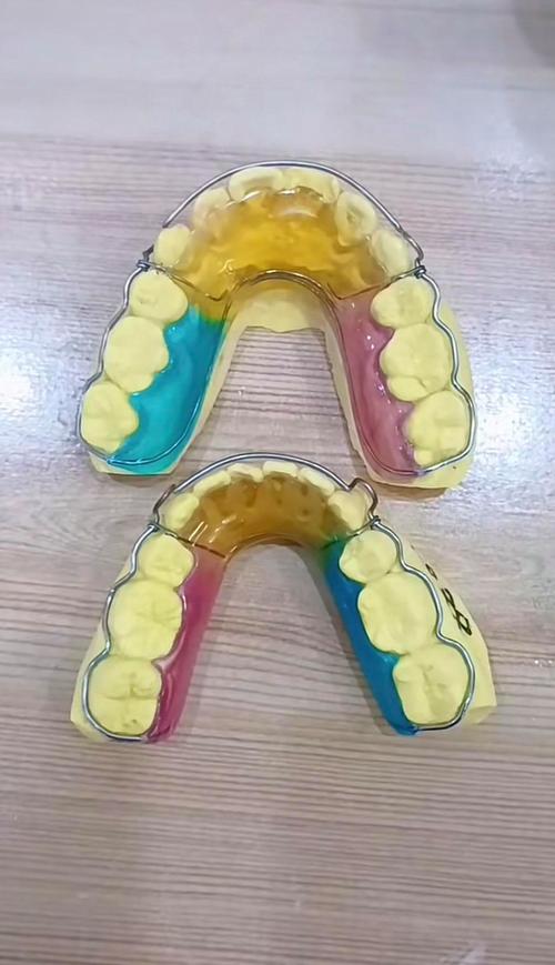 正畸保持器组成-图2