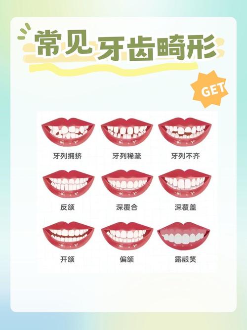 正畸有哪些类型？常见矫正方式有哪些？-图2