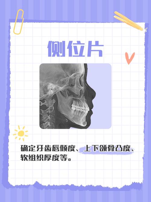 正畸骨面性课件-图2