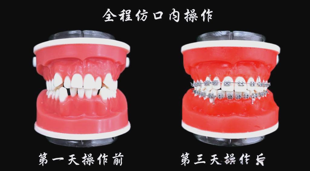 口腔正畸速成班-图3 口腔正畸速成班-图3