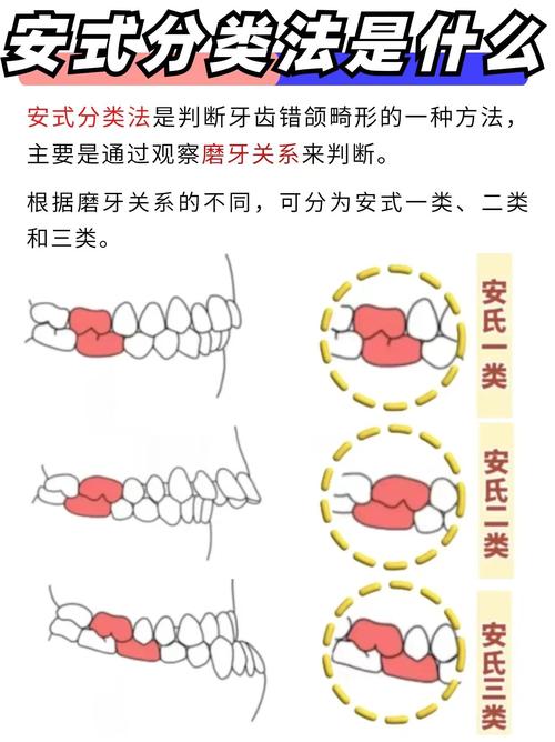 正畸骨型分类有哪些常见类型及标准?-图2 正畸骨型分类有哪些常见类型及标准?-图2