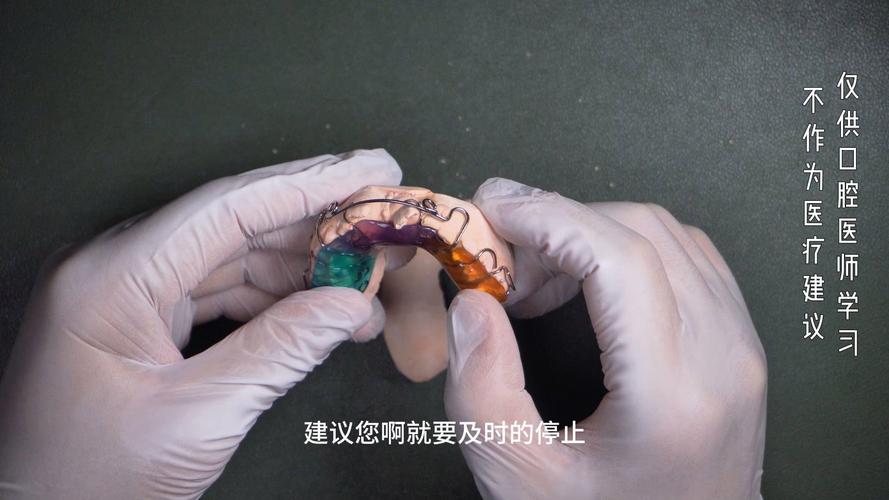 正畸菱形簧弯制-图2