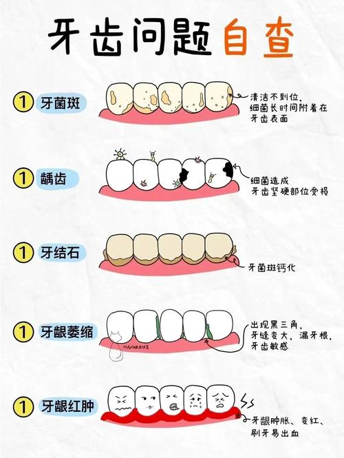 牙周问题和正畸-图2