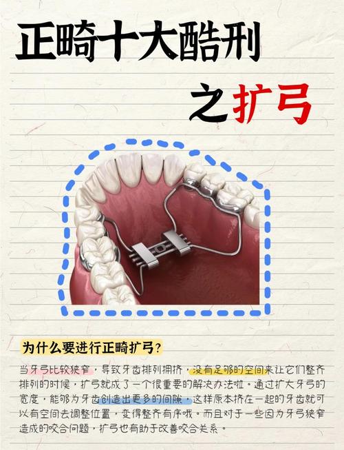 正畸扩弓的风险-图3