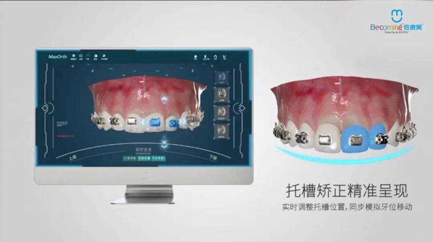 数字化正畸厂家-图1
