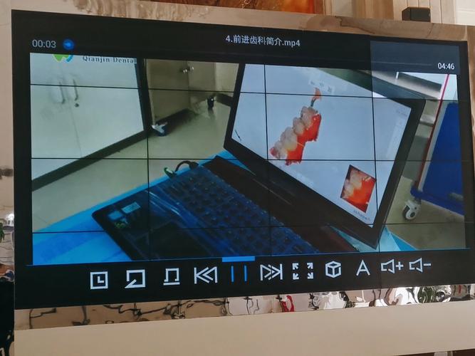 口腔正畸x光片-图1 口腔正畸x光片-图1