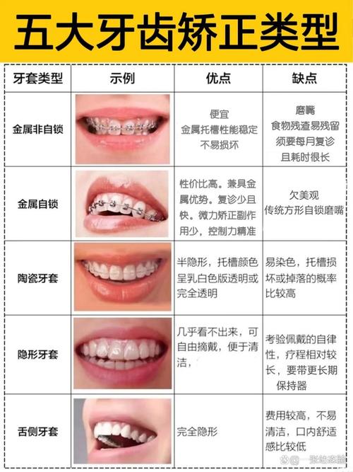正畸I类牙方案-图2