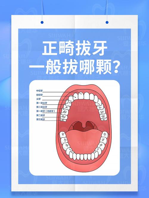 正畸拔牙示意图-图2