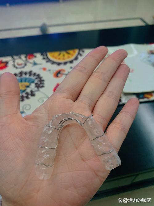 正畸门牙粘了垫-图2