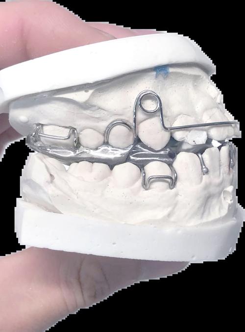 德国正畸矫正器-图1