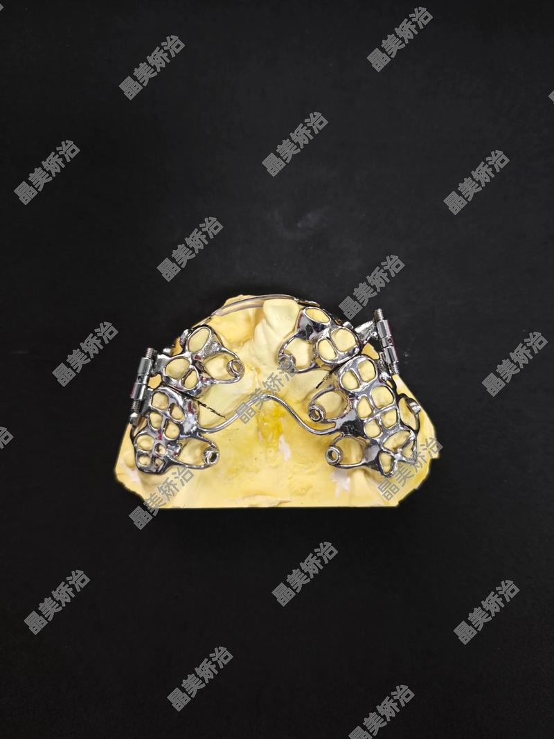 数字化正畸设计-图1