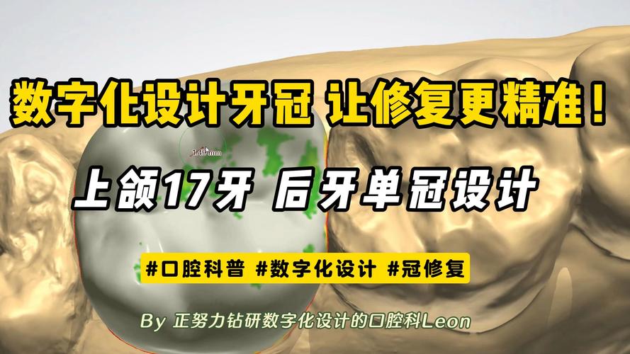 数字化正畸设计-图3