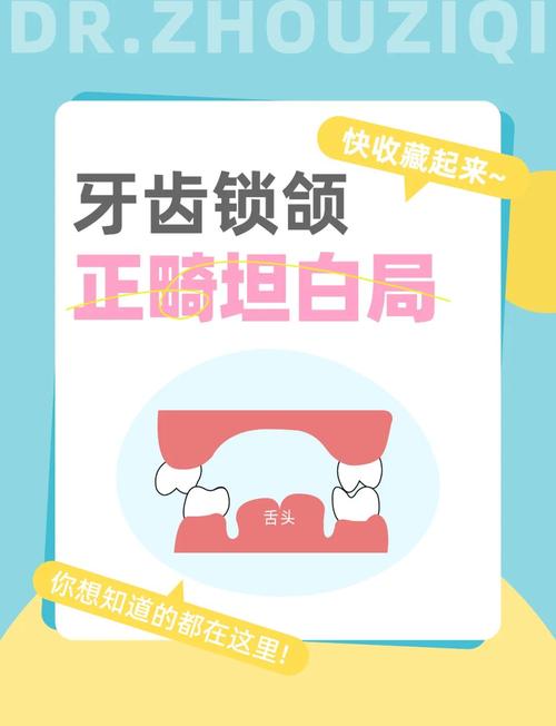 正畸导致牙锁颌-图2