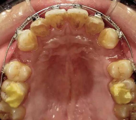 梅志强正畸视频讲什么？正畸效果靠谱吗？-图1