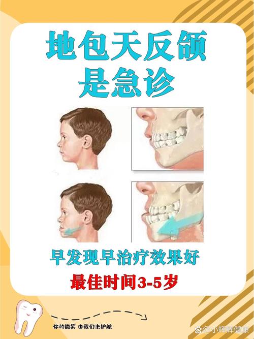 反颌正畸的危害-图3