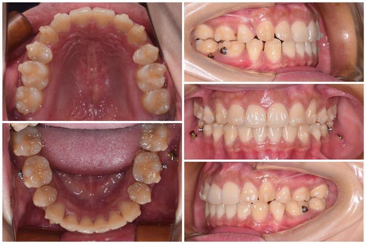 福州正畸梁甲兴靠谱吗？-图1