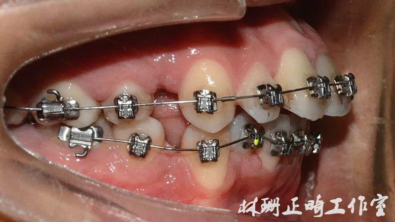 福州正畸梁甲兴靠谱吗？-图2