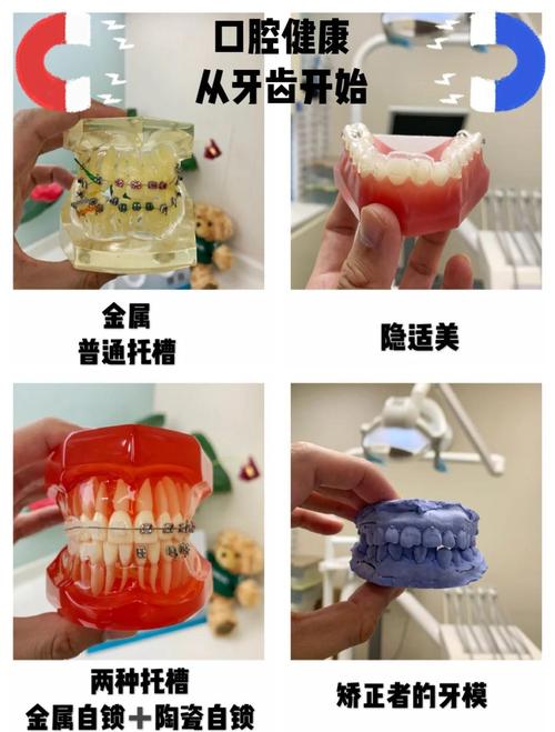 整牙和正畸区别-图2