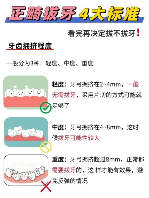 正畸分牙到底为啥要做?这一步有必要吗?-图2 正畸分牙到底为啥要做?这一步有必要吗?-图2
