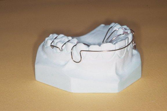 正畸艺术曲弯制-图2