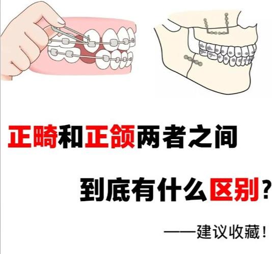 正颌前正畸经过-图1