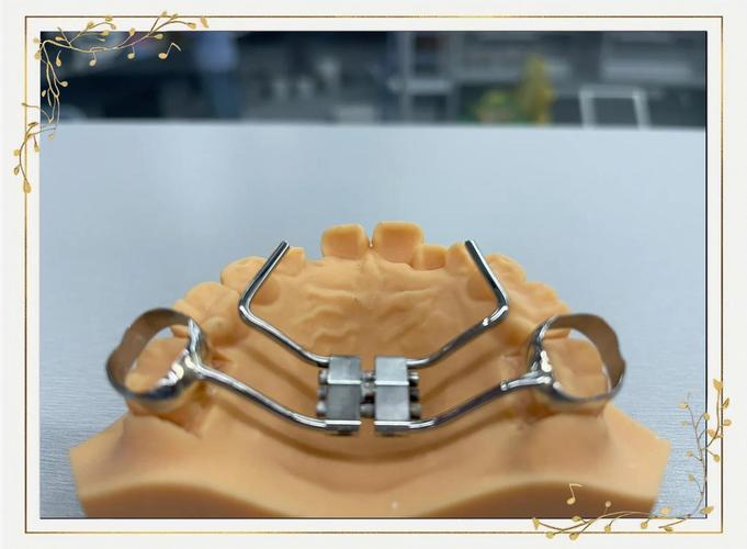 正畸弹簧扩弓器有何作用？使用方法与注意事项有哪些？-图2