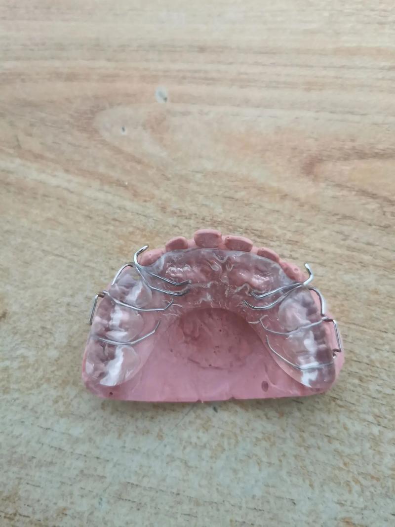 正畸口内阻挡臂-图1 正畸口内阻挡臂-图1