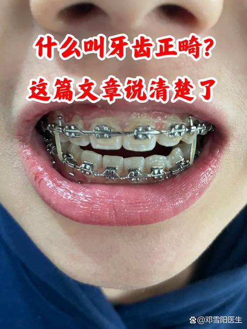 正畸博导是什么-图2