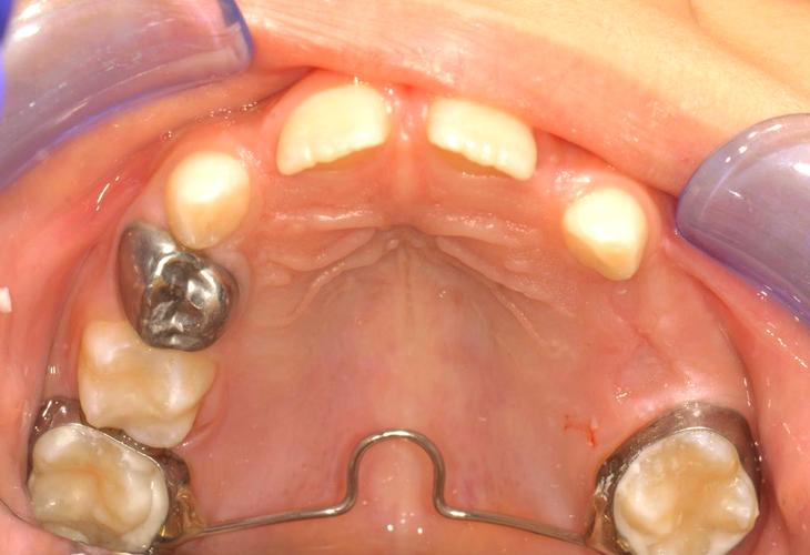灵长间隙 正畸-图1