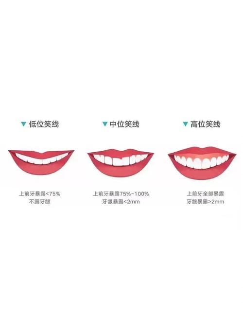 口腔正畸PM线-图1 口腔正畸PM线-图1