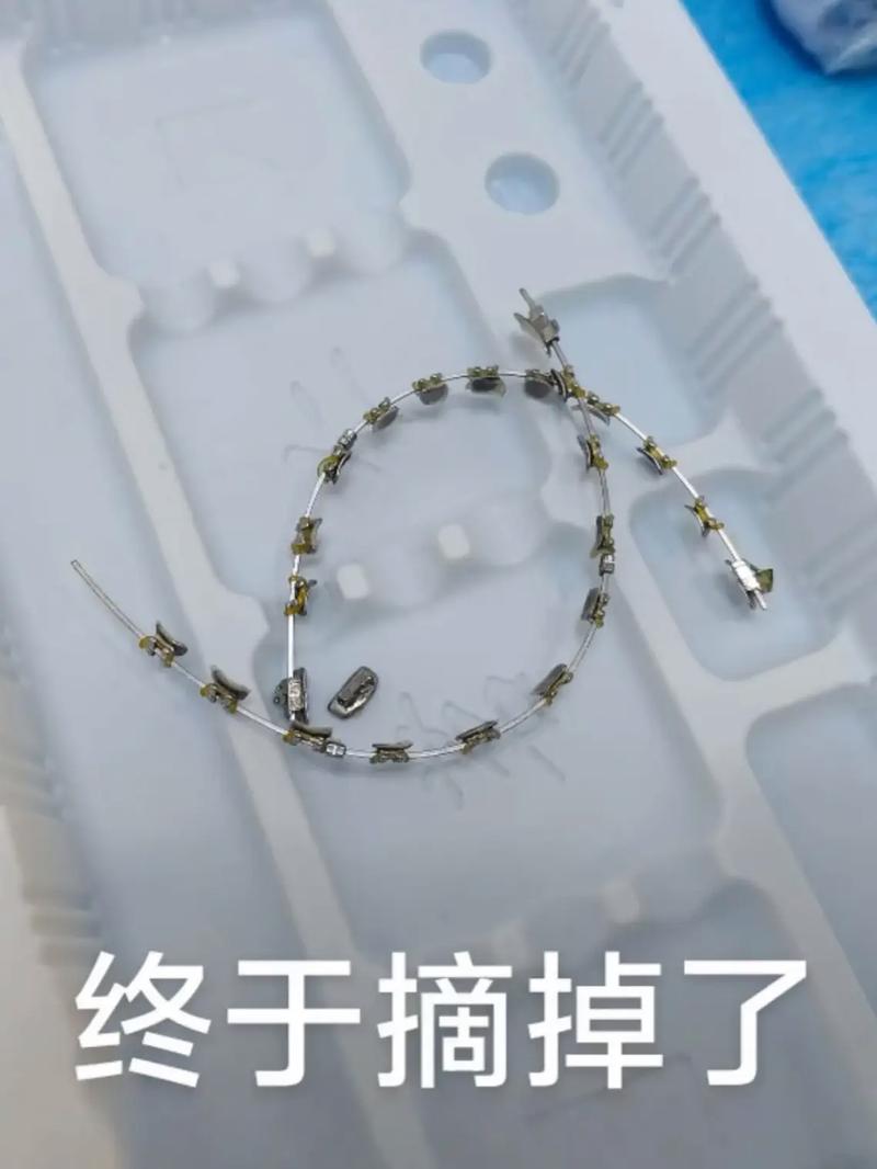 杭州正畸讨论群-图1