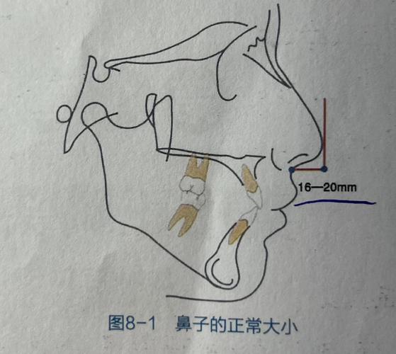 正畸z角 范围-图2