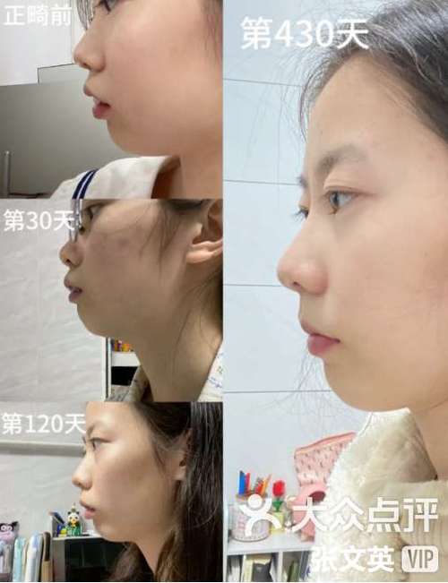 口腔正畸的现状-图1 口腔正畸的现状-图1