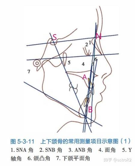 正畸用北医分析具体指什么?有何独特优势?-图2 正畸用北医分析具体指什么?有何独特优势?-图2
