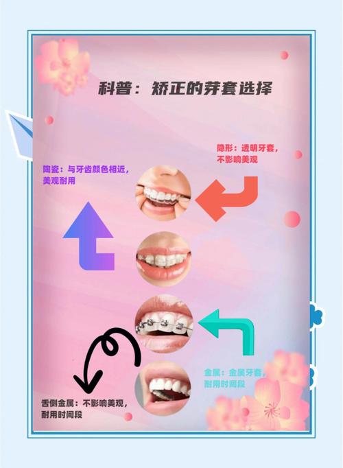 牙齿正畸全流程是怎样的？各阶段步骤、时间及注意事项有哪些？-图3