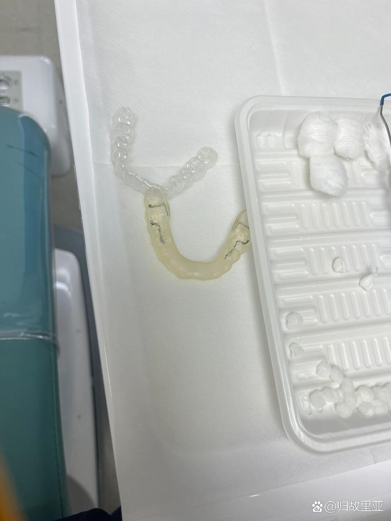 正畸 钢丝越粗-图2