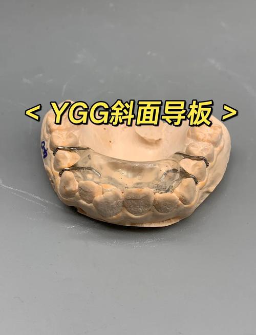 牙齿矫正导板有什么用-图3