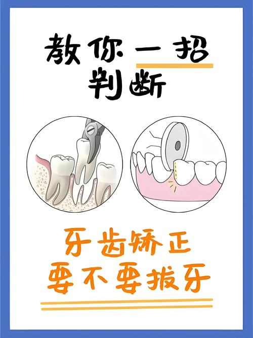 矫正牙齿拔牙的必要性何在？-图3