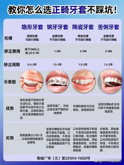 牙齿矫正器价格究竟是多少？不同材质与品牌差异有多大？-图2