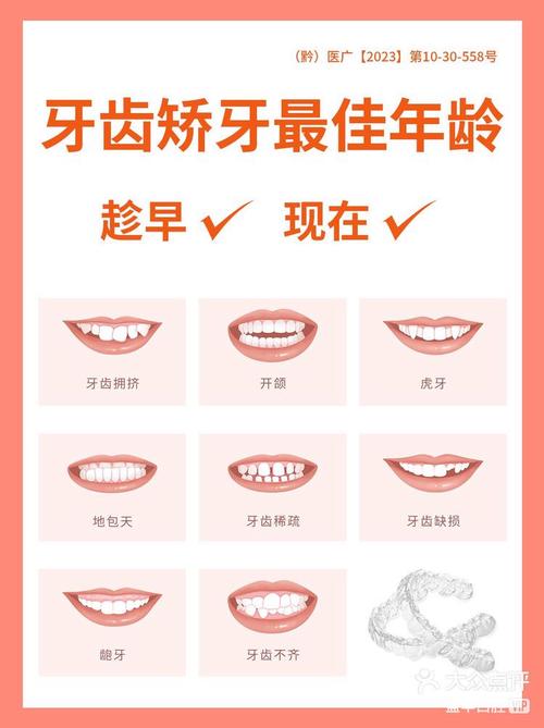 成年矫正牙齿多长时间-图3