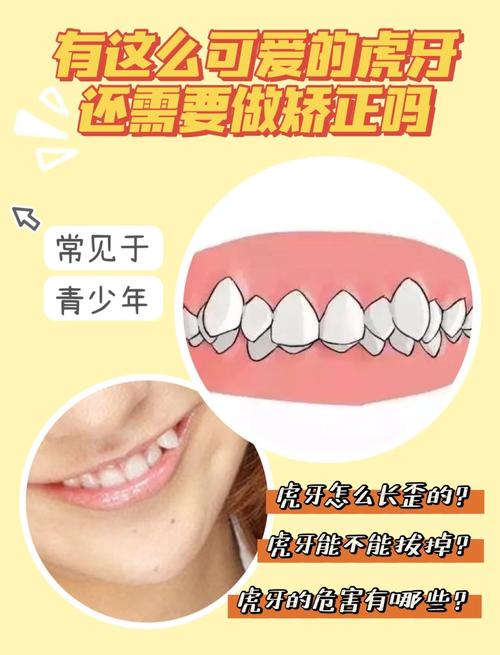有虎牙怎么做牙齿矫正-图1